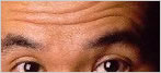 botox Leeds