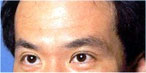 botox Leeds