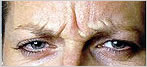 botox Leeds