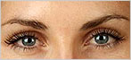 botox Leeds