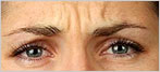 botox Leeds