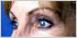 Botox Wakefield