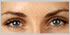 botox Leeds