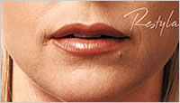 botox in  Leeds