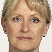 botox Leeds