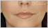 botox Leeds